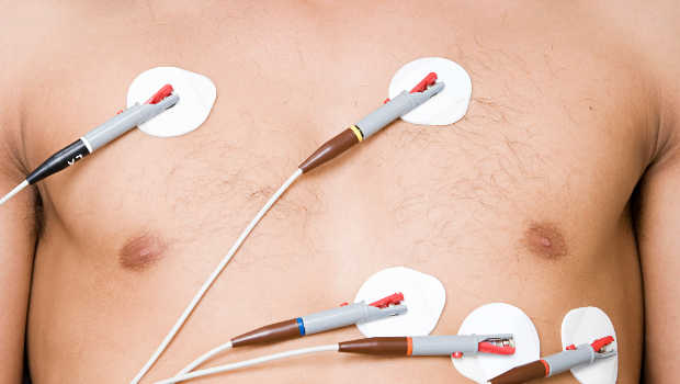 electrodes-chest-2col.jpg