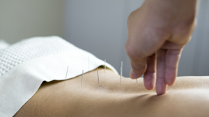 Acupuncture_for_back_pain_1col.png