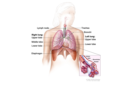 lung-cancer-image-450-border.jpg