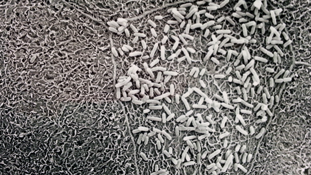 Resistent-E.-coli-rises_photo-Sokurenko-Lab_2col.jpg