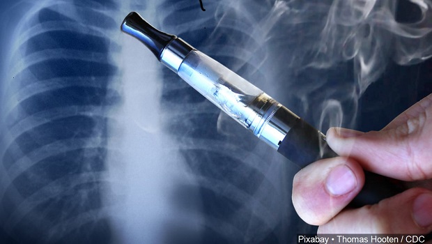 A vape in front of an X-ray of a patient's lungs