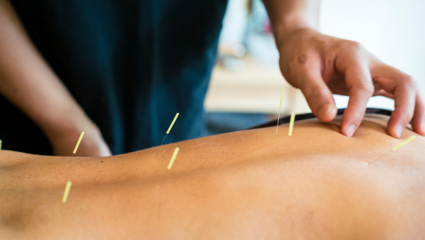 Acupuncture Acupuncture vs.